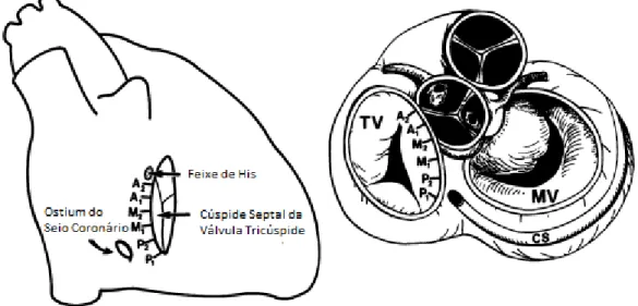 Figura  10.  Este  diagrama  apresenta  a  orientação  anatómica  do  cateter  de  ablação  na  TRNAV