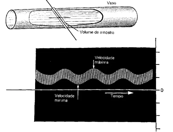 Figura  9.  Representação  de  exposição  uniforme  de  um  vaso  e  gráfico  espectral  Doppler  obtido (Nyland &amp; Matoon, 2004)