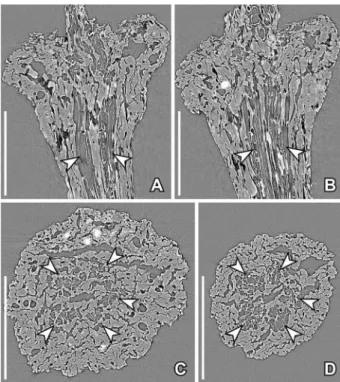 Figure 6. SRXTM reconstructions of pedicel and receptacle anat- anat-omy in Paisia pantoporata gen