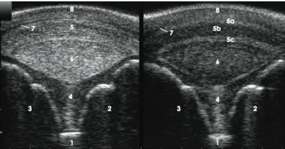 Figura 9- Imagens obtidas na abordagem ecográfica palmar do boleto, nível C, corte trans- trans-versal;  imagem  positiva  à  esquerda  e  negativa  à  direita,  lado  medial  à  esquerda  (imagem  adaptada de Seignour et al