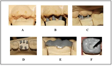 Figura  2  -  Técnica  convencional  de  enceramento:  A-  a  partir  da  vista  vestíbulo-oclusal  é  possível  visualizar  a  articulação  da  cúspide  vestibular  do  primeiro  molar  superior  com  o  sulco   mesio-vestibular do primeiro molar inferior