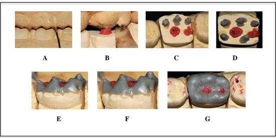 Figura  3  - Técnica  gnatológica  de  enceramento:  A-  A  partir  da  vista  vestibular  visualiza-se  a  conexão 