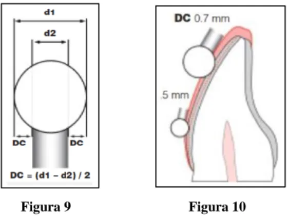 Figura  9  -  Broca  esférica  diamantada:  D1  representa  o  diâmetro  total  da  broca,  D2  corresponde  ao  diâmetro da ponta da broca e DC a profundidade do corte ideal na preparação dentária