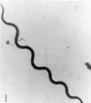 Figura 12 – Fotografia de microscopia electrónica de Borrelia hispanica 