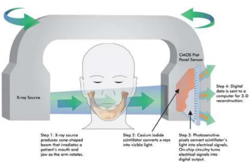Figura 3- Na técnica de CBCT, um feixe de radiação cónico irradia a mandíbula do doente