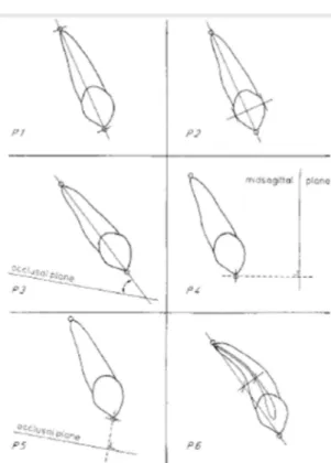 Figura 8 - Ilustração dos diferentes parâmetros (Gavel &amp; Dermaut, 1999). 