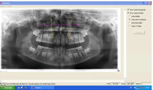 Figura  16 - Método B (Screenshot do Software) 