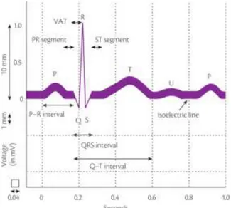 Figure 3 – Illustration of ECG signal detection. 