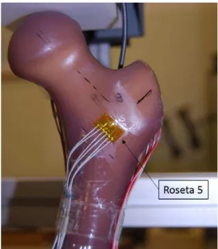 Figura 3.18 - Posicionamento da roseta 5. 