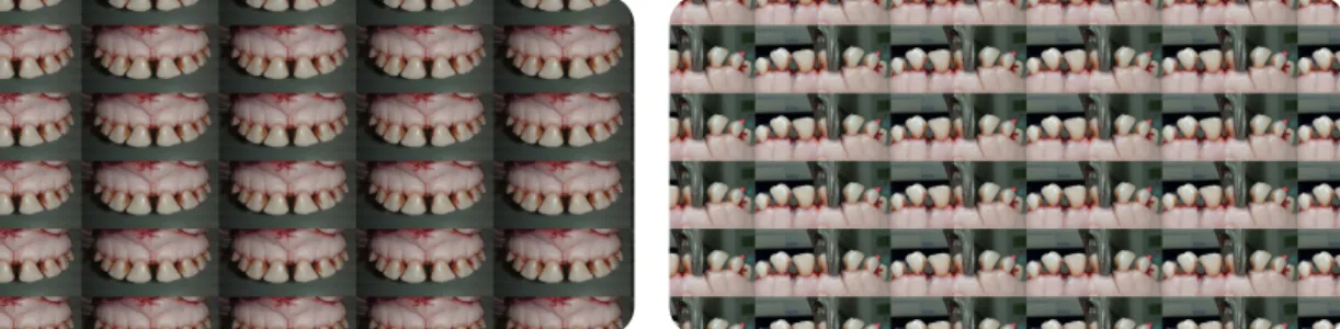 Figura 10 - Dentes de bovino  Figura 11 - Exodontia dos dentes de bovino 