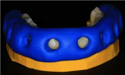 Figura 9- Guia de silicone.  