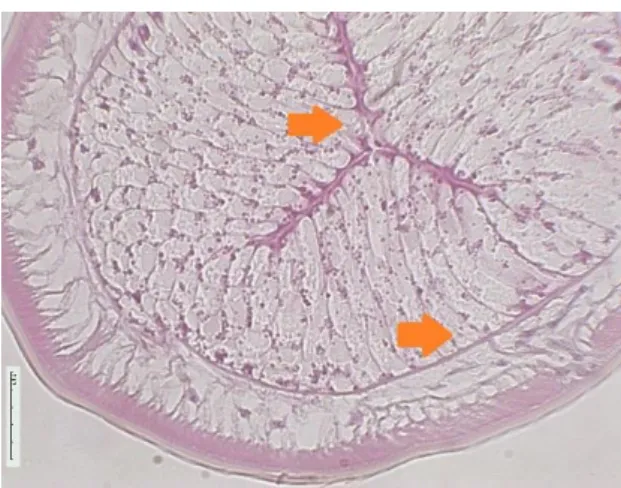 Figura 14 - Grupo A1 do 2º Ensaio (ampliação 40x)  Barra de escala 5 µm (setas: lúmen do intestino)  Alargamento do lúmen intestinal e lesões  degenerativas