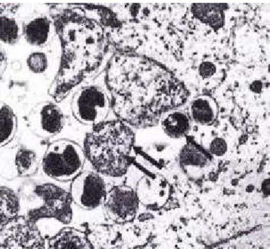 Fig. 2. Microfotografia eletrónica de um fino corte de inclusão de  Chlamydia (→  Corpo elementar; 