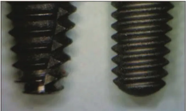 Figura 5 - Comparação entre implantes com formas diferentes. O implante da  esquerda tem uma forma cónica e o da direita tem uma forma cilíndrica, retirado de 
