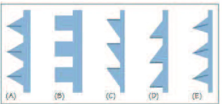 Figura 7 - Os diferentes padrões das roscas dos implantes. (A) Padrão em V; (B) Padrão  quadrado; (C) Padrão Buttress; (D) Padrão Buttress Revertido; (E) Padrão em espiral, adaptado 