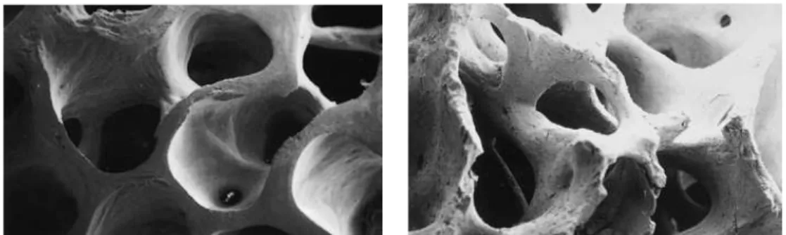 Figura  6  –  A  imagem  da  esquerda  mostra  a  morfologia  e  microestrutura  de  um  osso  humano  (imagem  MEV,  ampliação  x  50)  (Adaptado  de  Kolk  et  al.,  2012)