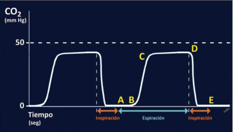 Figura 9 - Capnografia