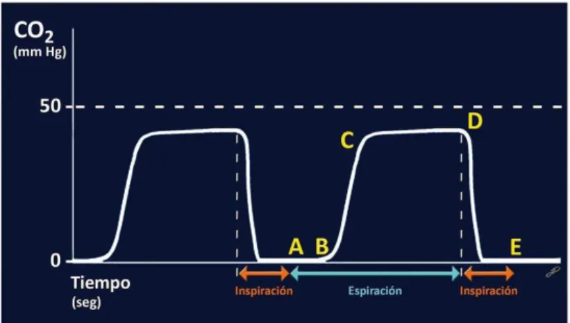 Figura 2 - Capnografia