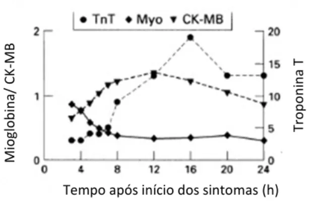 Figura 3.3 – Cinética de biomarcadores cardíacos de necrose miocardial (Adaptado de De winter et  al.,1996) 