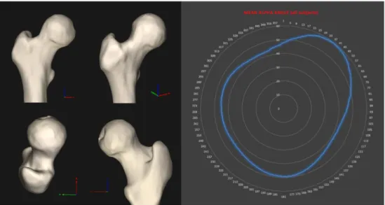 Fig. 4 Cam deformity prevalence: overall participants and gender-specific breakdown by different alpha angle ( α °) thresholds (50, 55, and 60°)