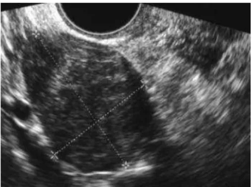 Figure 1 Ultrasonography 