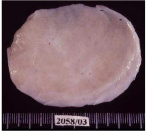 Figure 5 Surgical specimen 
