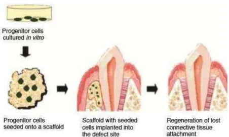 Figura  10  -  Representação  esquemática  da  engenharia  tecidular  periodontal.  Uma  matriz  obtida  através  da  engenharia tecidular in vitro (esquerda) contendo as células necessárias e moléculas de sinalização, colocada 