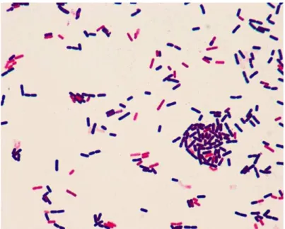 Figura 2 – Observação microscópica de uma coloração de Gram de células de  Clostridium sp