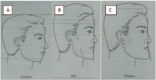 Figura 1 - Tipos de perfis  