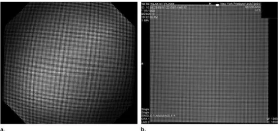Fig. 10 Pincushion effects, S distortion e vignetting em II e FPD a) Imagem de II mostra distorção das linhas e vignetting