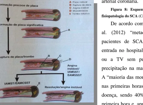 Figura  8:  Esquema  explicativo  acerca  da  fisiopatologia do SCA (Callaway, 2012). 