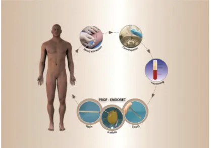 Figura 5 – Esquema ilustrativo sobre a técnica do PRGF. (Anitua,  Alkhraisat, &amp; Orive, 2012) 