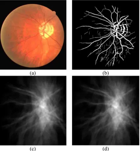 Fig. 2. (a) Original retinal image; (b) segmented vascular network; (c) entropy map calculated using full resolution images; (d) entropy map calculated using low resolution images.