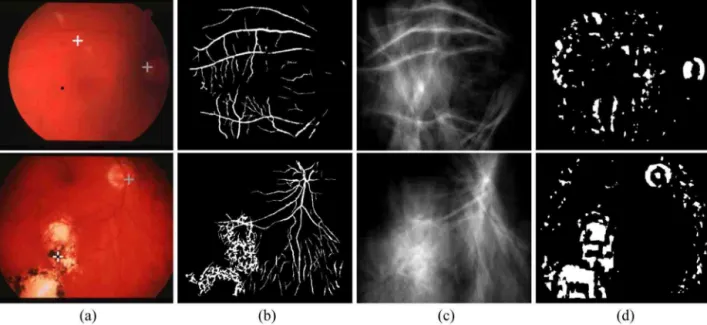 Fig. 4. Results of validation phase. (a) Original images showing the absolute maximum of entropy (black dot), the initial OD position estimation (white cross) and the result of new OD location estimation resulting from the validation phase (gray cross); (b