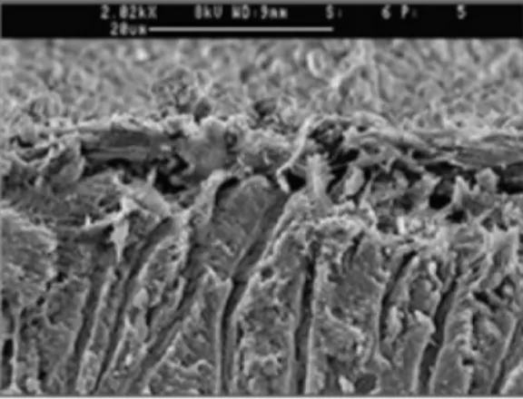 Figura  1:  Imagem    microscópica  da  superfície  da  dentina  coberta  por  detritos  orgânicos  (adaptado  Haapasalo, M