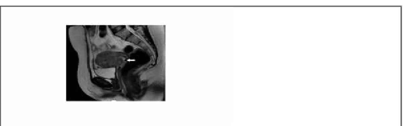Figure 1 Pelvic MR