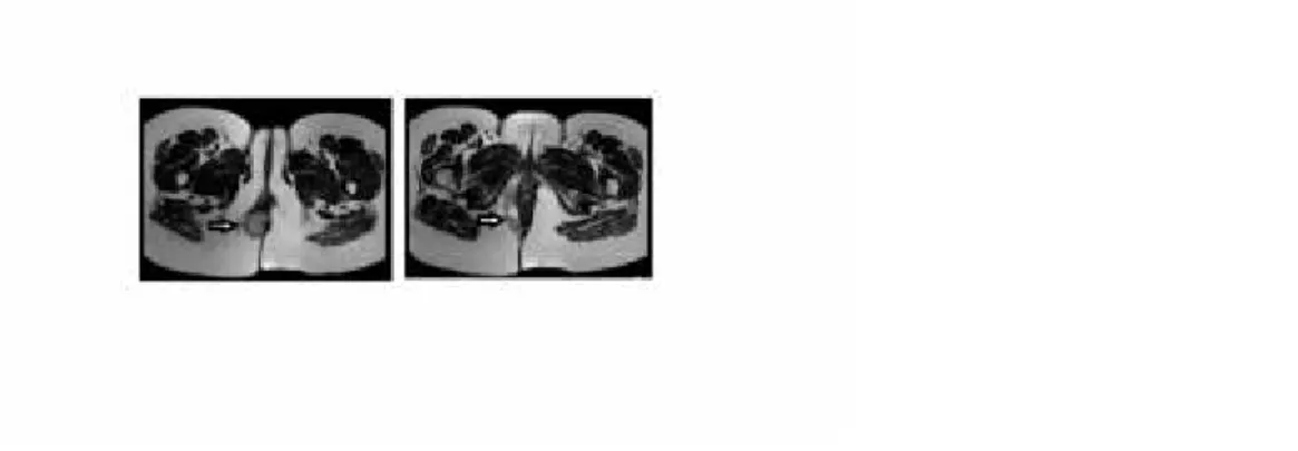 Figure 3 Pelvic MR