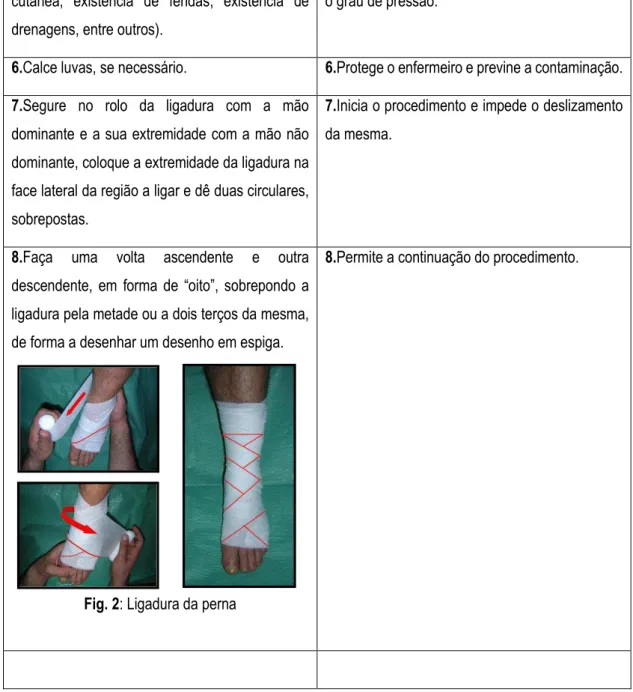 Fig. 2: Ligadura da perna 
