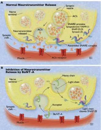 Figura 1 - Mecanismo de ação da TB. A- Ação normal na junção neuromuscular B- Presença da TB na  terminação nervosa, clivagem do complexo SNARE e posterior inibição da libertação da ACh para o 