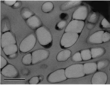 Figura 1 - Acumulação de PHA no interior de bactérias (a barra representa 0,5 µm). Adaptado de  Sudesh, Abe &amp; Doi ( 2000)