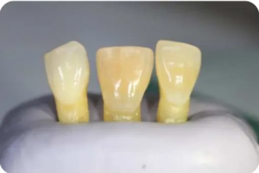 Figura 4 - Dentes monoradiculares humanos 