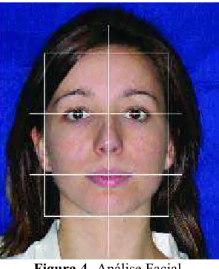 Figura 4- Análise Facial. 