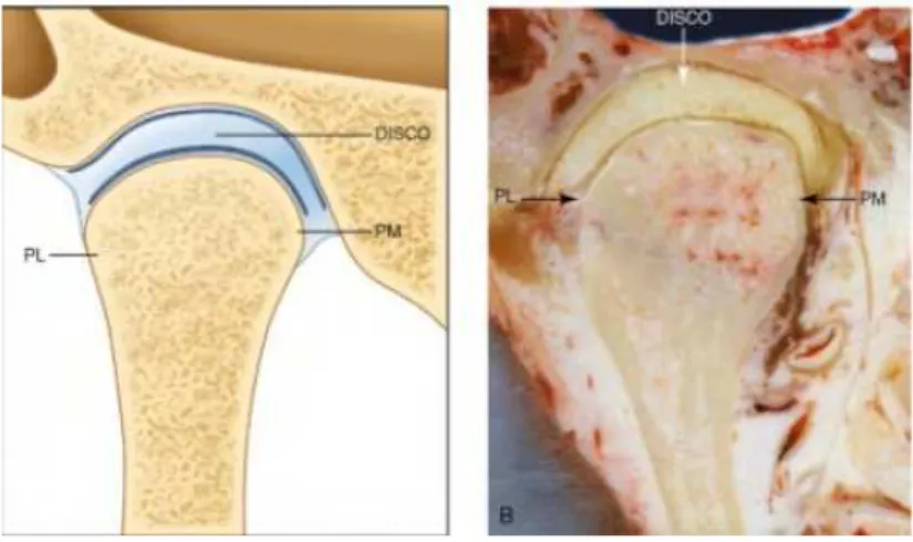 Figura 2: Disco articular adaptado à anatomia da fossa e do côndilo. PL: polo lateral; PM: polo  medial (Retirado de Okeson, 2003) 
