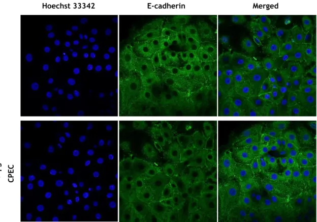 Figure  20:  Effect  of  LPS  incorporation  in  E-cadherin  integrity.  Representative  E-cadherin  immunocytochemistry  confocal  images  from  CPEC  incubated  with  0.1µg/mL  LPS  during  24  hours  in  newborn rats