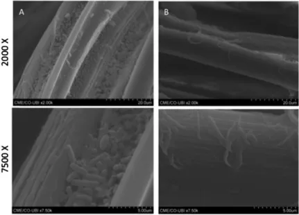 Figure 5. SEM images of control SF (a) and SF- L -Cys after five washing cycles (b).