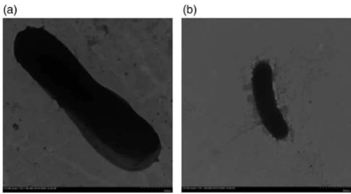 Figure 6. TEM images of K. pneumoniae that was in contact with control SF (a) and SF- L -Cys after five washing cycles (b).