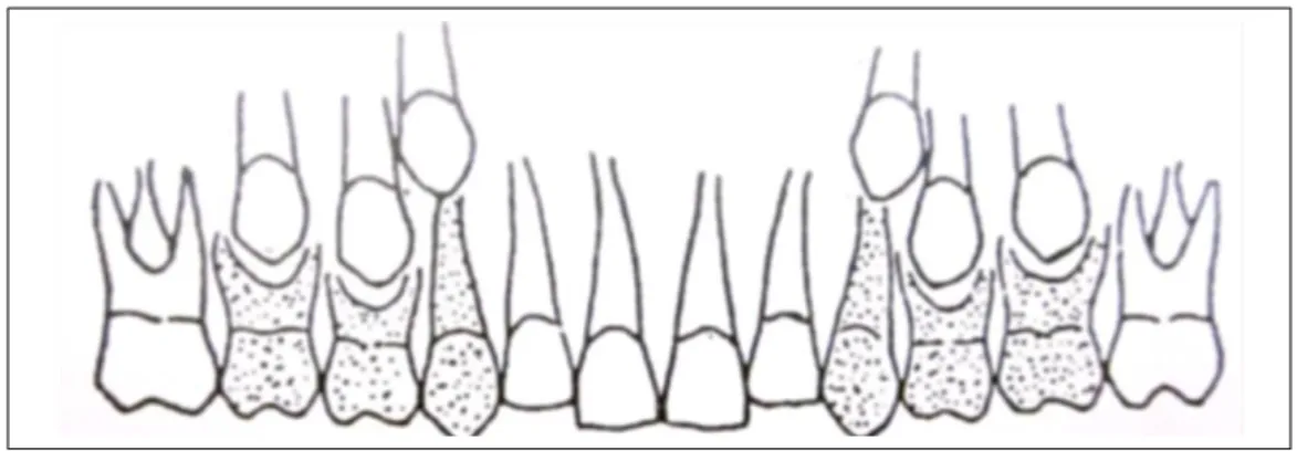 Figura  3  -    Diagrama  realçando  a  Zona  de  Suporte  e  a  respectiva  substituição  dos  dentes  permanentes