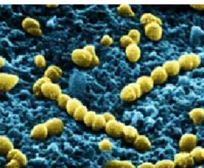 Fig. 1 Streptococcus pneumoniae 