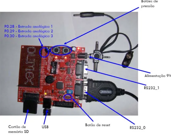 Figura 3.  Kit ALFATxp e seus componentes principais. 