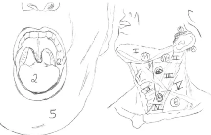 Figura 1  - Metástases de primário oculto na cabeça e pescoço segundo a revisão sistemática